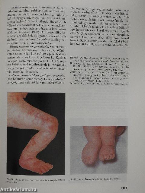 Az újszülött 1-3.