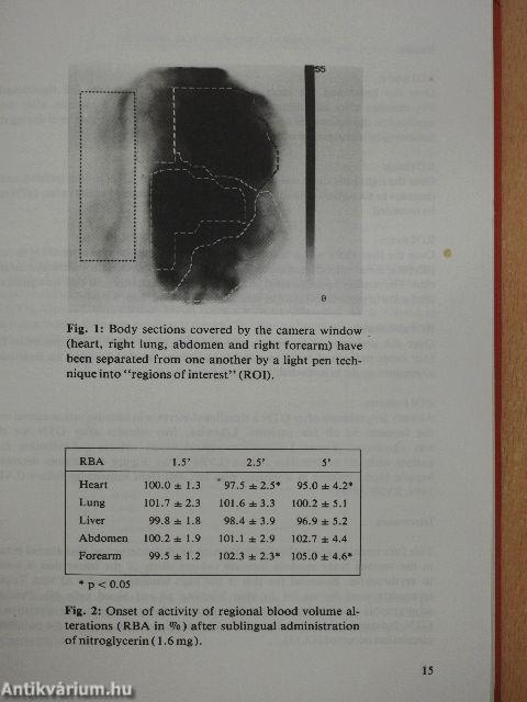 Nitroglycerin 4.