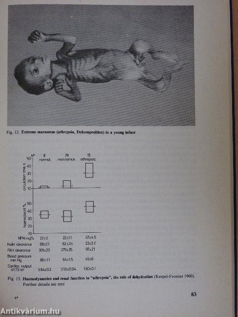 The Pathophysiology of Infantile Malnutrition