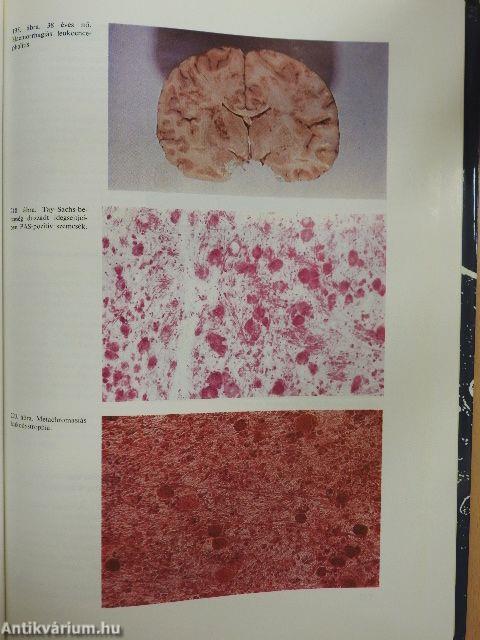 Neuropathologia