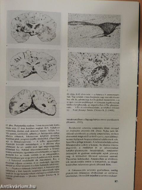 Neuropathologia