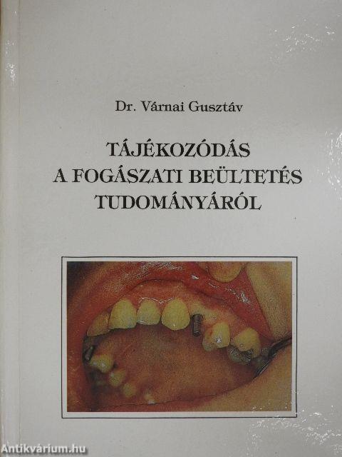 Tájékozódás a fogászati beültetés tudományáról