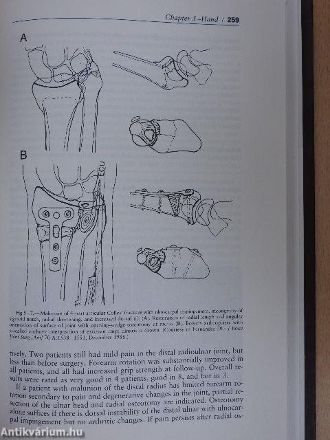 The Year Book of Orthopedics 1989