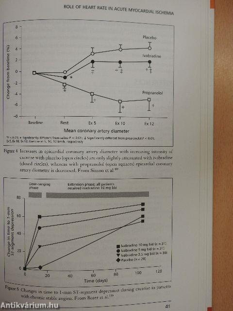 Heart Rate Management in Stable Angina