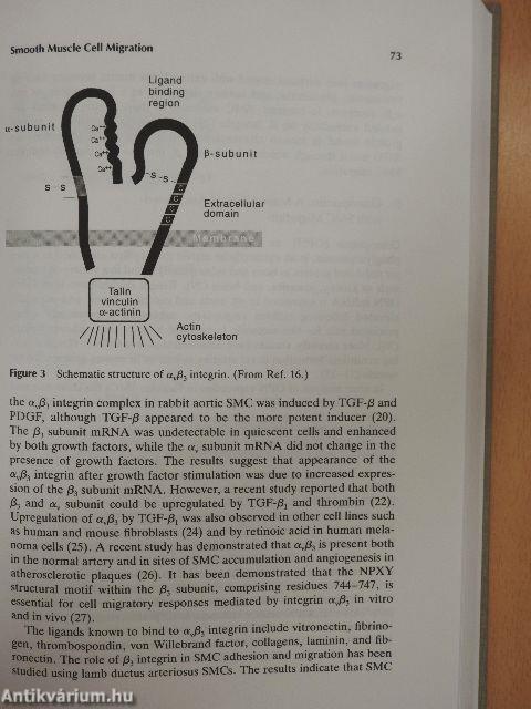 Coronary Restenosis