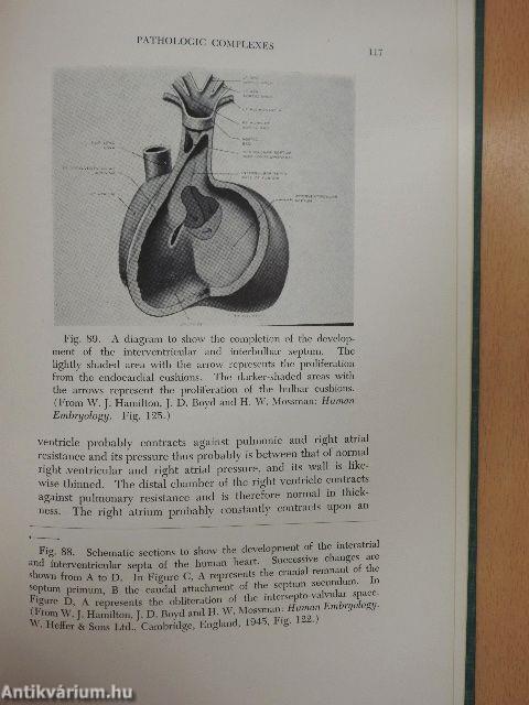 Autopsy Diagnosis of Congenitally Malformed Hearts