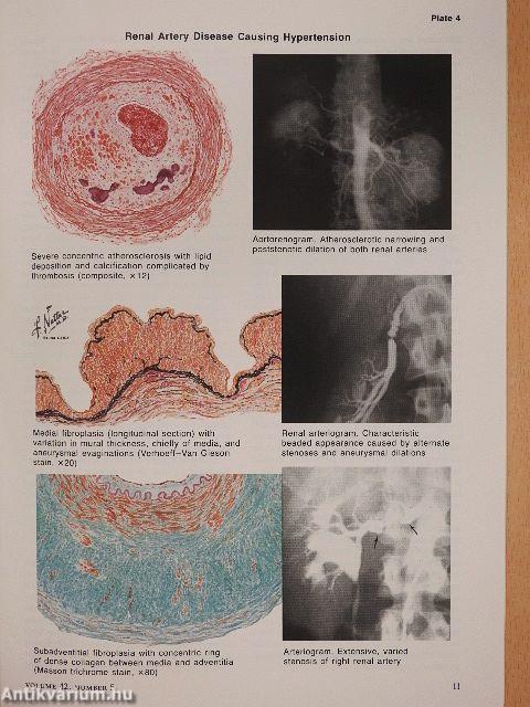 Clinical Symposia 5/1990