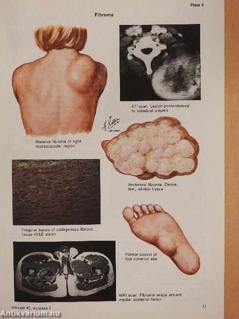 Clinical Symposia 1/1990