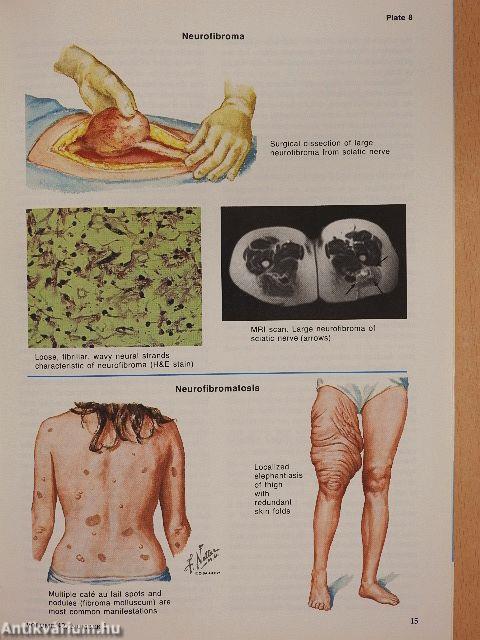 Clinical Symposia 1/1990