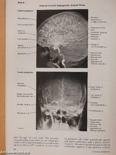 Clinical Symposia 3/1990