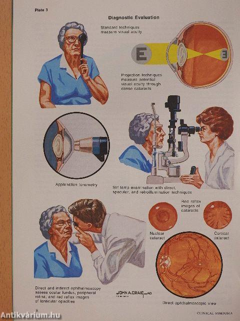 Clinical Symposia 4/1990