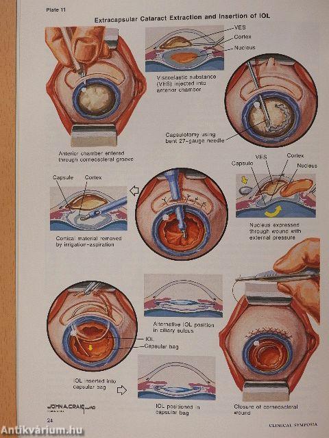 Clinical Symposia 4/1990