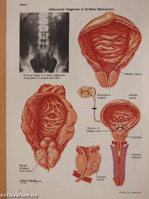 Clinical Symposia 2/1989