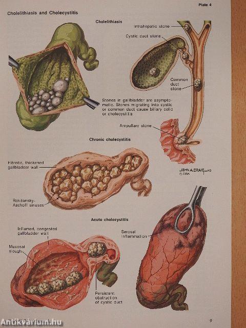 Clinical Symposia 4/1982