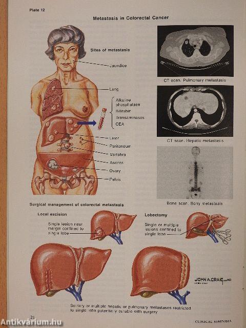 Clinical Symposia 5/1989