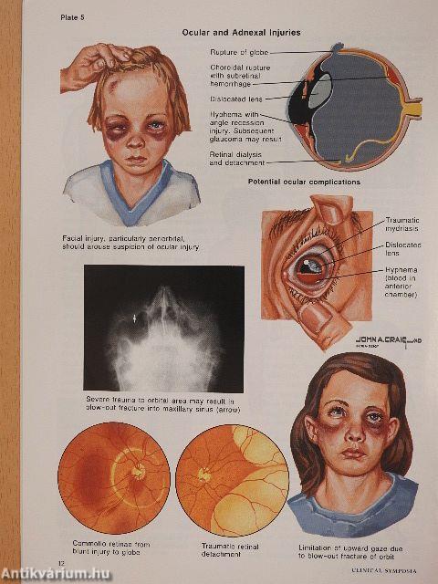 Clinical Symposia 1/1991