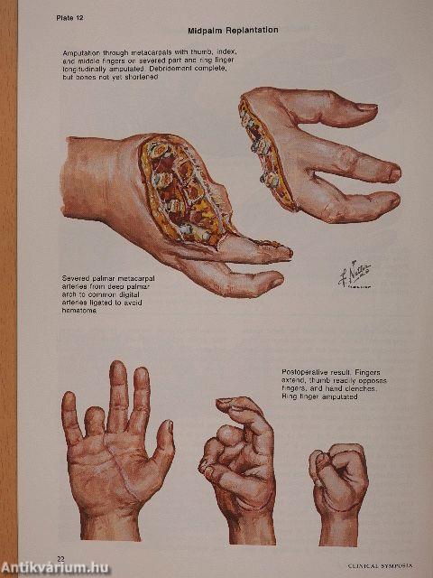 Clinical Symposia 2/1991