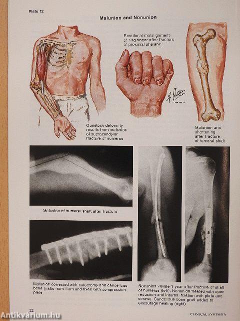 Clinical Symposia 3/1991