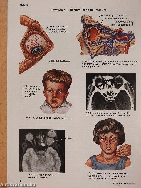 Clinical Symposia 4/1991