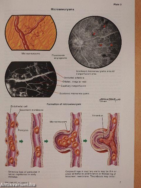 Clinical Symposia 1/1992