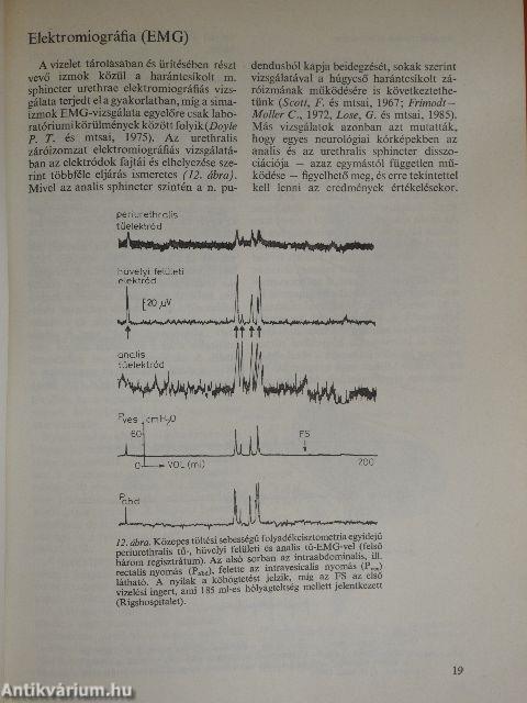 Női vizelettartási zavarok