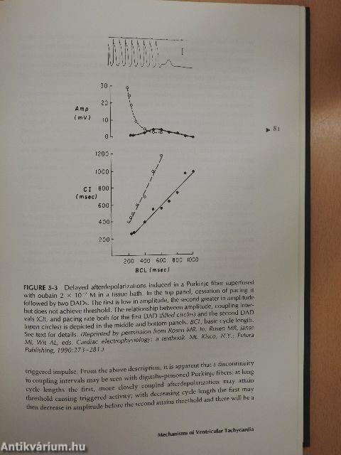 Sudden Cardiac Death