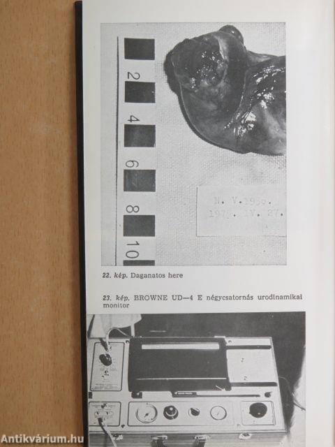Az urológia válogatott fejezetei (diagnosztika)