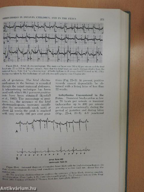 Essentials of Cardiac Arrhythmias