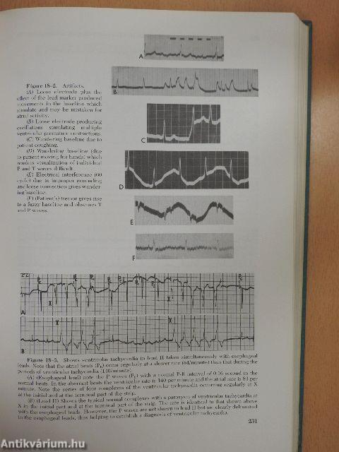 Essentials of Cardiac Arrhythmias