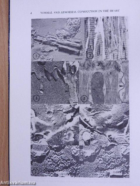 Normal and Abnormal Conduction in the Heart