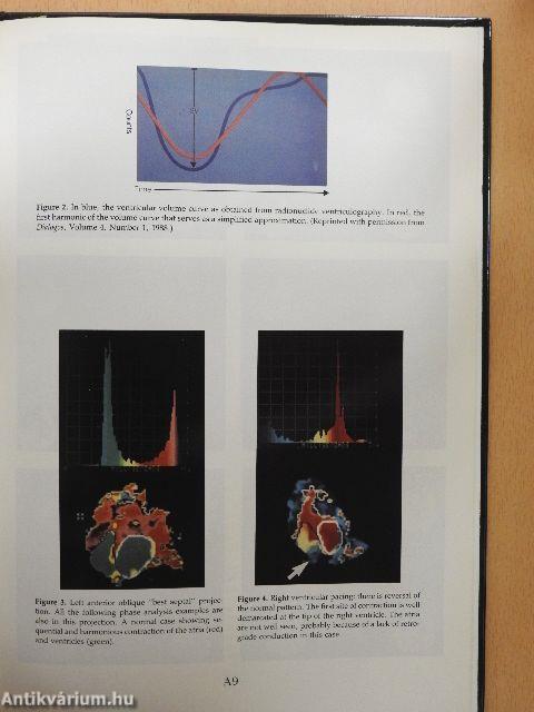 Cardiac Mapping