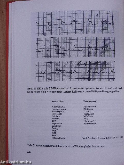 Nitroglycerin IV