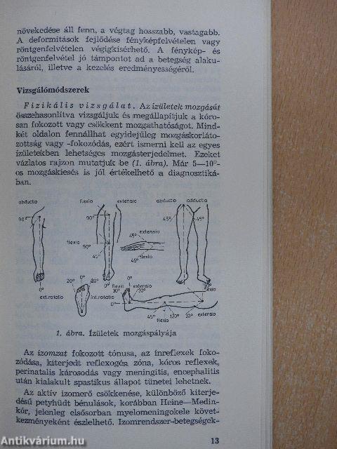 Gyermek-orthopaedia