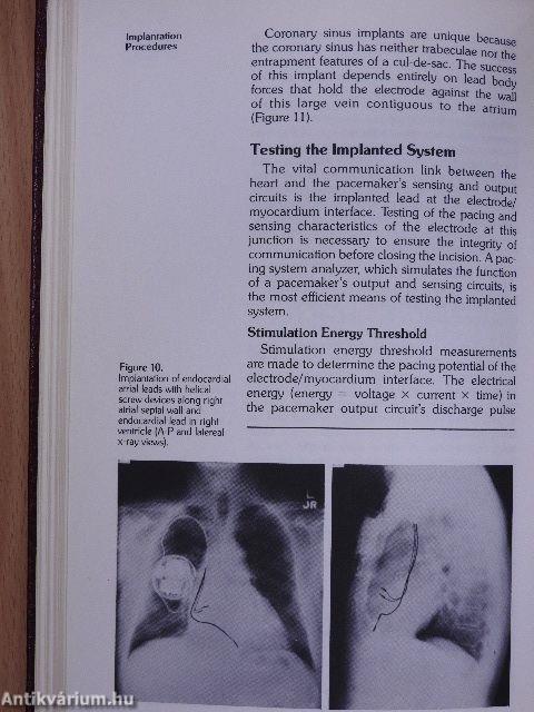 Current Clinical Applications of Dual-Chamber Pacing