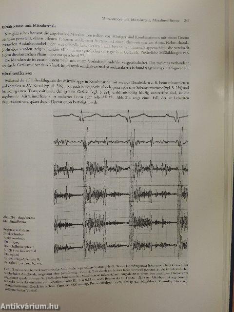 Atlas und kurzgefaßtes Lehrbuch der Phonokardiographie und verwandter Untersuchungsmethoden