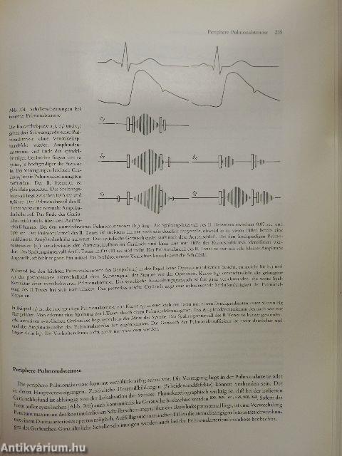 Atlas und kurzgefaßtes Lehrbuch der Phonokardiographie und verwandter Untersuchungsmethoden