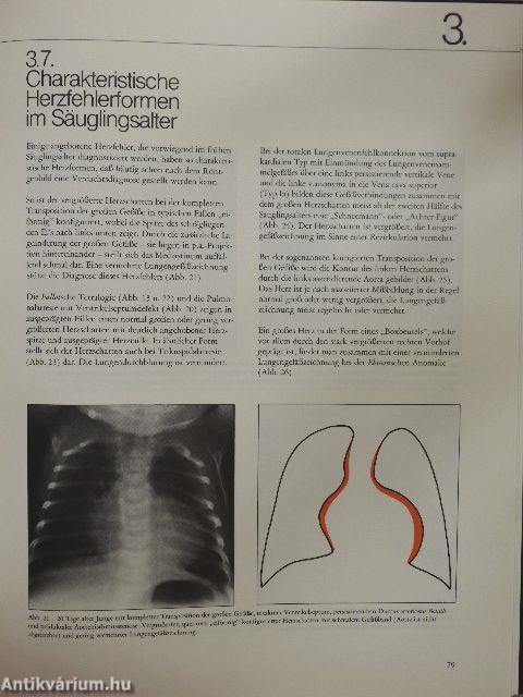 Diagnostik angeborener Herzfehler 1.