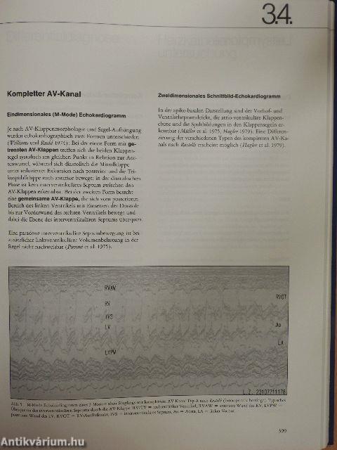 Diagnostik angeborener Herzfehler 2.