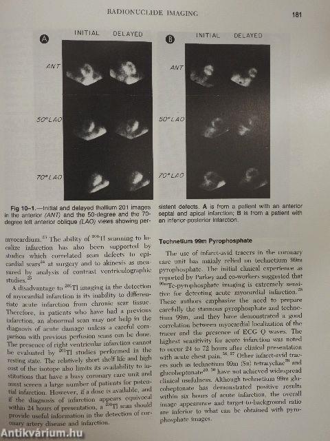 Noninvasive Cardiac Imaging