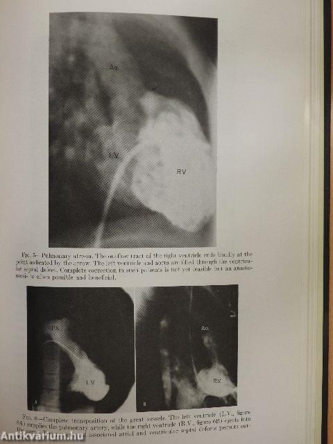 Visual Aids in Cardiologic Diagnosis and Treatment