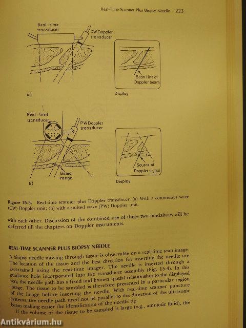 Diagnostic Ultrasonics