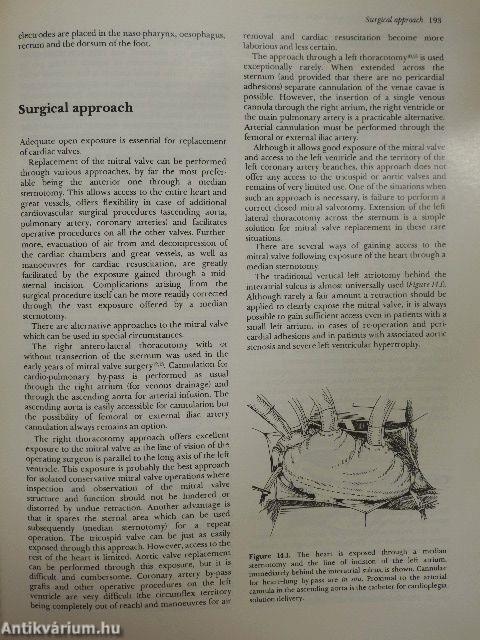 Mitral Valve Disease