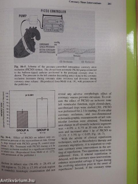 Acute Coronary Intervention