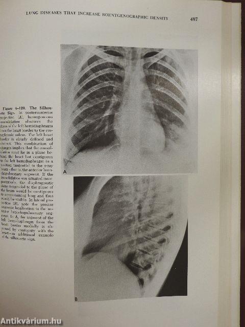 Diagnosis of Diseases of the Chest I.