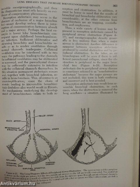 Diagnosis of Diseases of the Chest I.