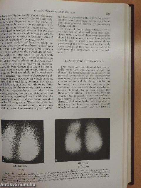 Diagnosis of Diseases of the Chest I.