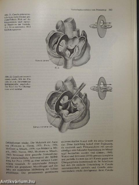 Herzchirurgie I-II