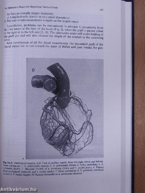 Coronary Artery Surgery in the Nineties