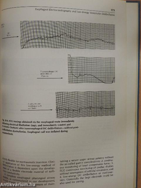 Advances in Cardiopulmonary Resuscitation