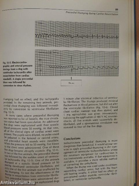 Advances in Cardiopulmonary Resuscitation